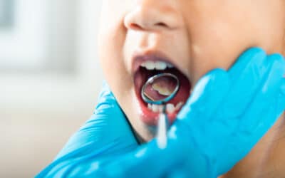 What Causes Cavities in Children?